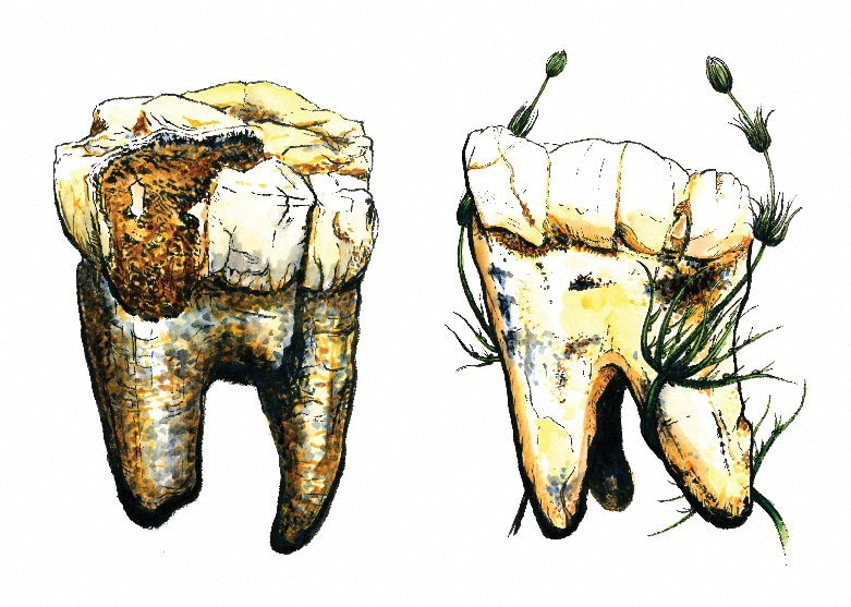 An illustration of two of the seven molars from Australopithecus, unearthed in South Africa, that were sampled in new research exploring the diet of this important ancient human ancestor. The image was released on January 16, 2025 An illustration of two of the seven molars from Australopithecus, unearthed in South Africa, that were sampled in new research exploring the diet of this important ancient human ancestor. The image was released on January 16, 2025