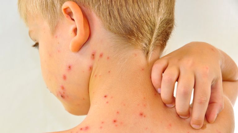 What vaccines are children recommended to have and when? | Science, Climate & Tech News